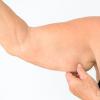 Как повысить упругость кожи: витамины, упражнения, кремы и салонные процедуры Народные средства для упругости кожи лица